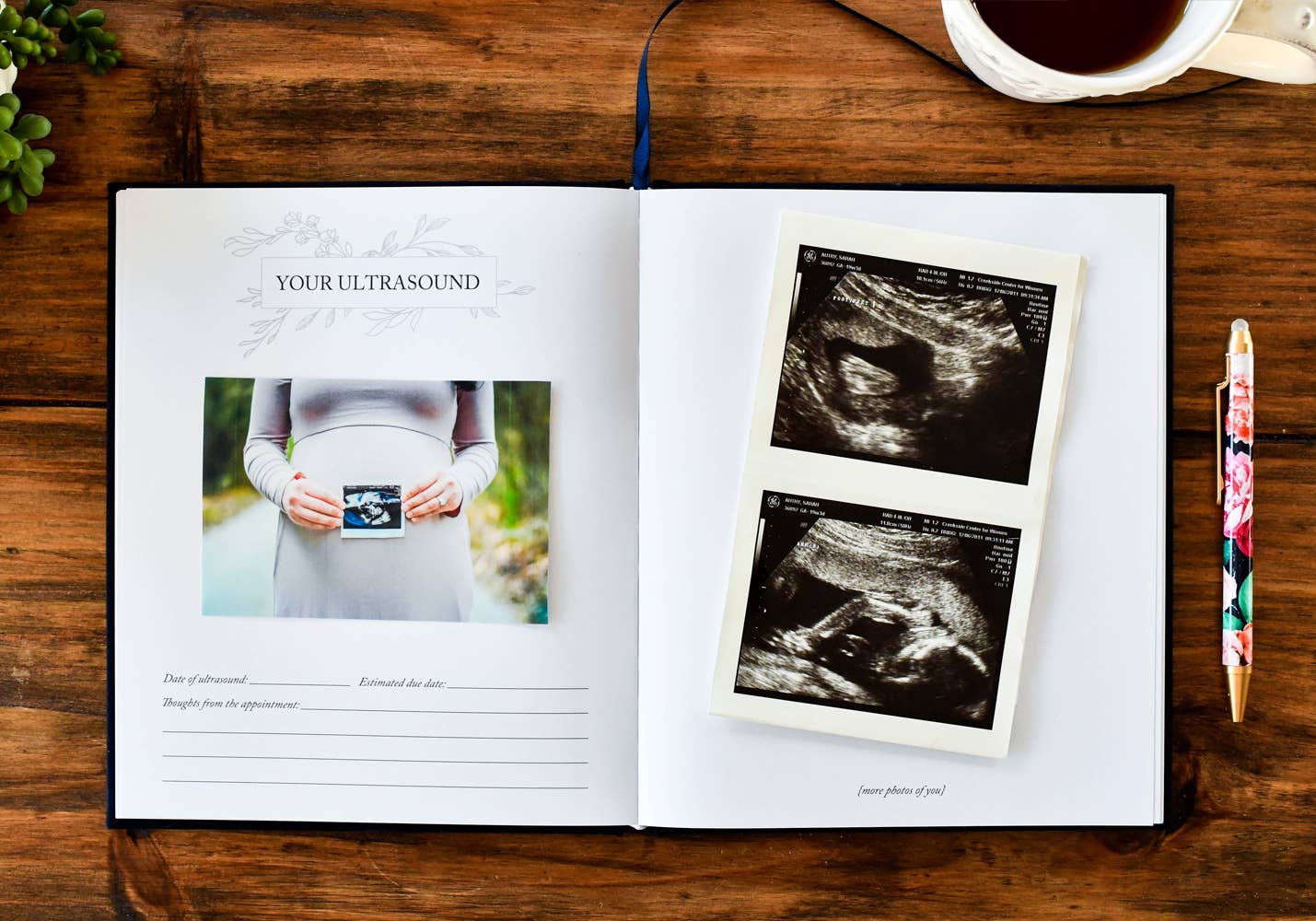 CC Dear Baby: A Pregnancy Prayer Journal & Memory Book for Moms
